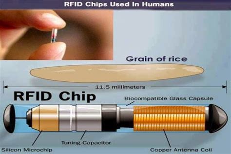 nbc news rfid chip 2017|These Unbelievably Tiny Tags Promise Big Advances in Medical .